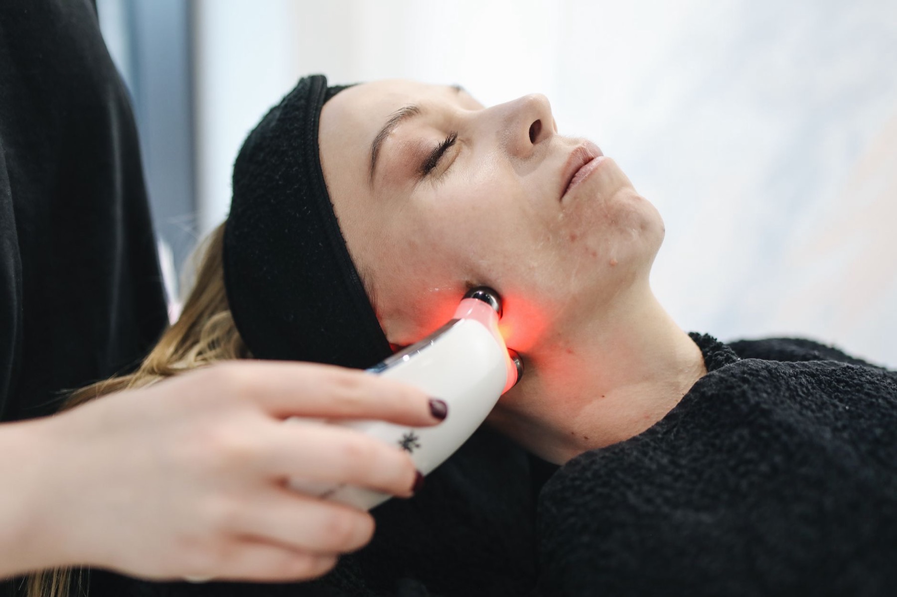RF Skin Tightening